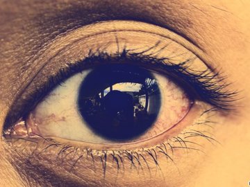 Göz Enfeksiyonunun Nedenleri Nelerdir?